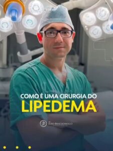 como é a cirurgia de lipedema