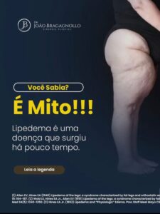 o que é lipedema