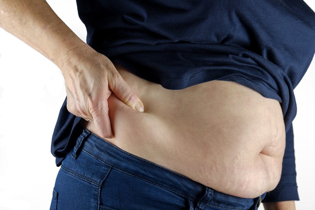 lipedema e linfedema gordura em excesso