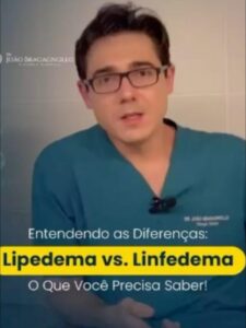 lipedema ou linfedema