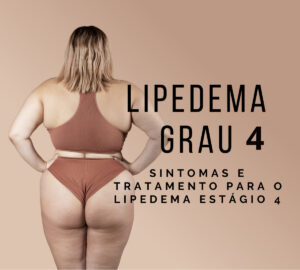 lipedema grau 4 estagio 4