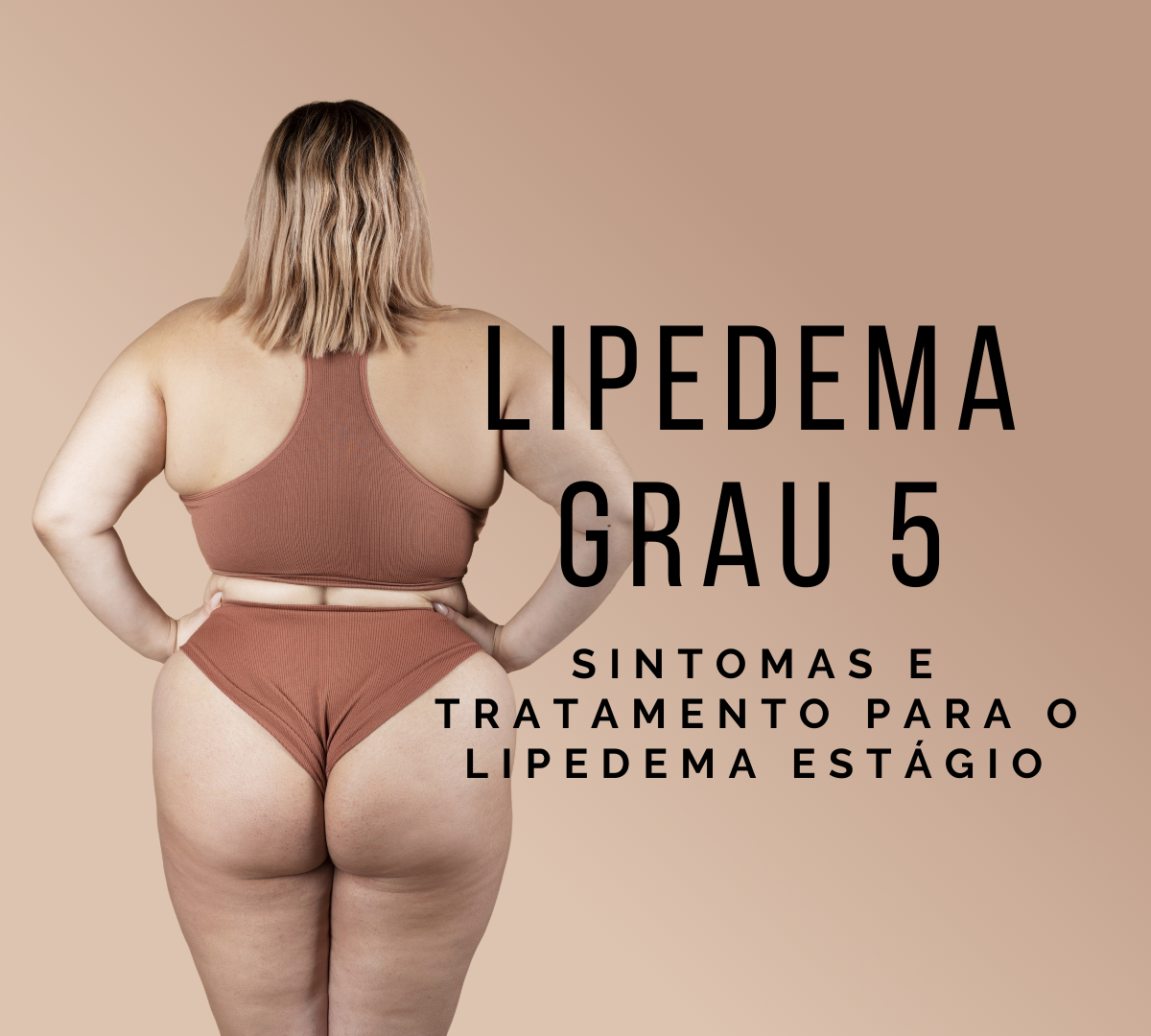 Lipedema Fotos: Pernas, braços e tornozelos - Dr. João Bragagnollo