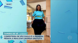 lipedema ou obesidade