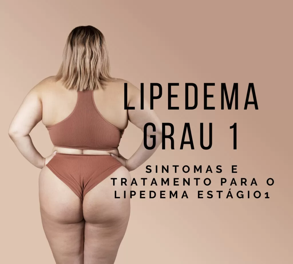 lipedema grau 1 estagio 1