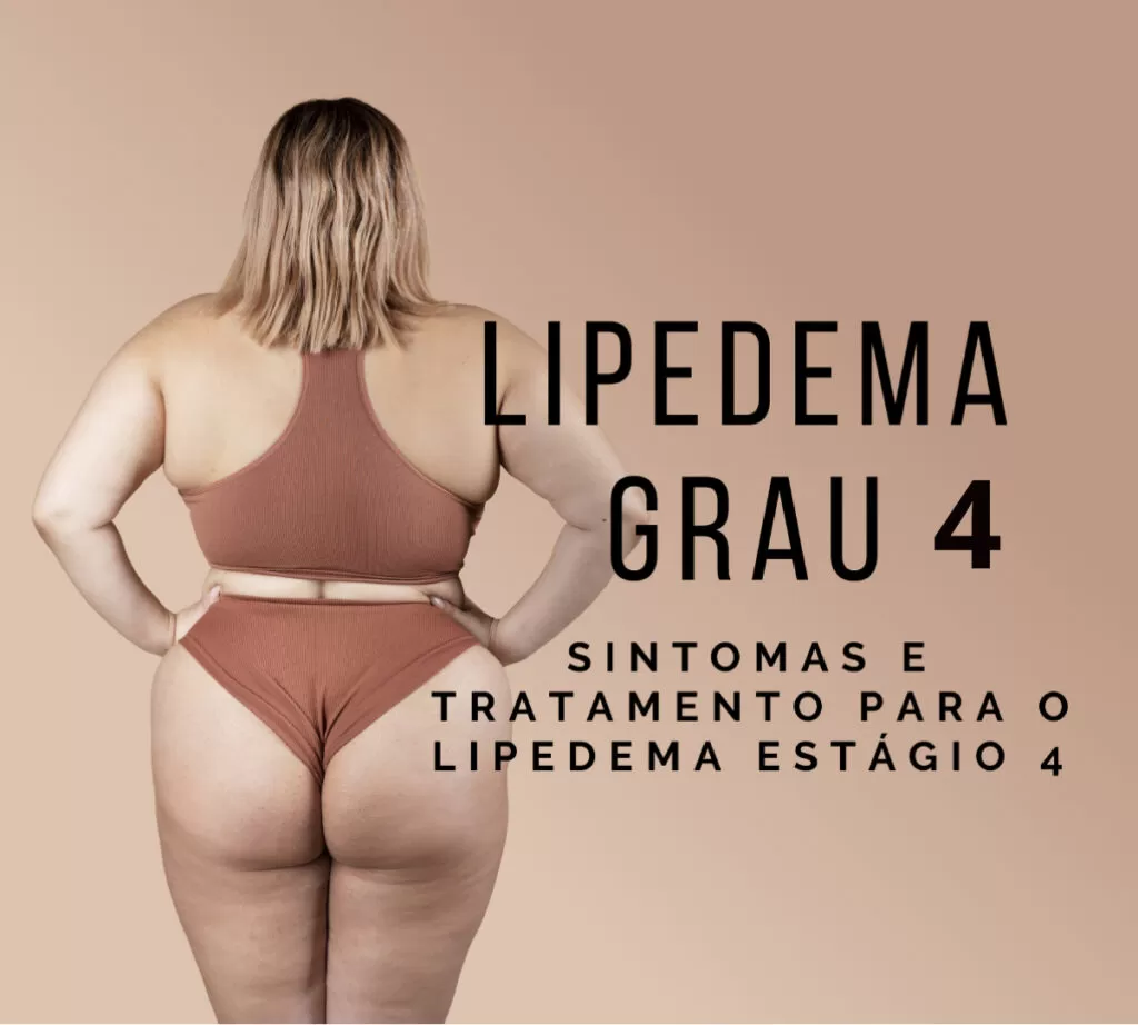 lipedema grau 4 estagio 4